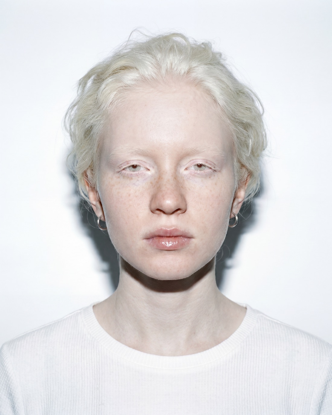 Casting portrait: albinism, pale lashes and brows